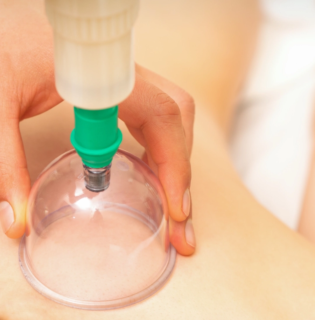 FizioValeri_vakum_terapija_1